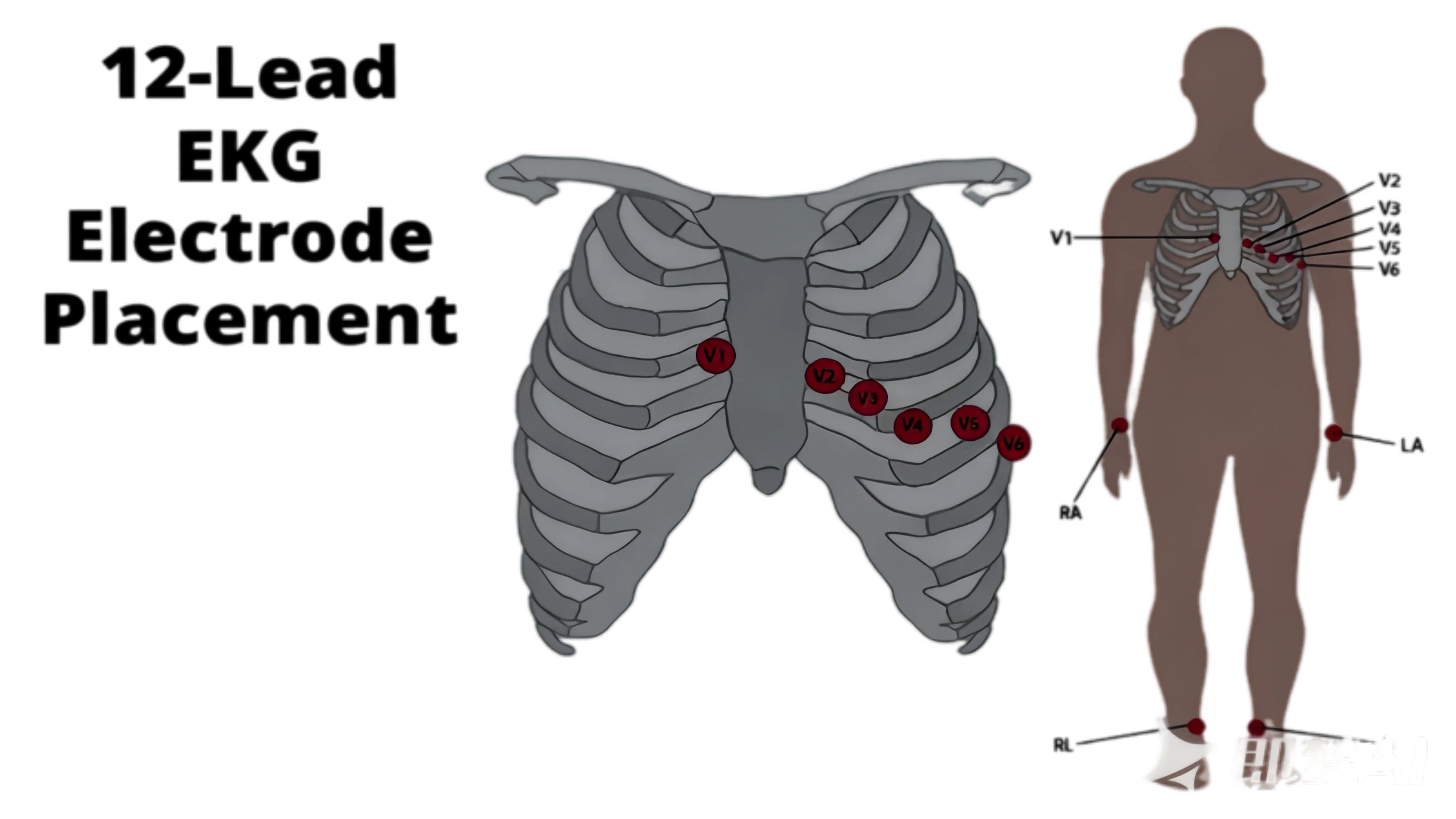 12 Lead ECG Placement Female: How to Position Leads on Women Patients