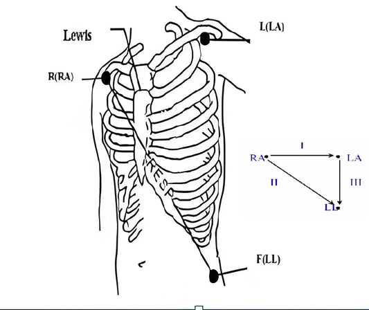 Quickly-Master-the-Types-and-Usage-of-ECG-Lead-Wires-with-One-Diagram MED-LINKET CORP