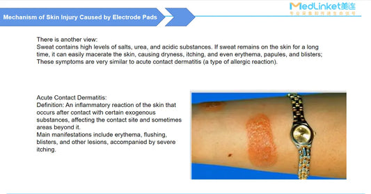 ECG Skin Preparation: 5-Step SOP, Hair, Alcohol & Holter Guide 2026