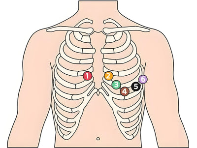 12 Lead ECG Placement