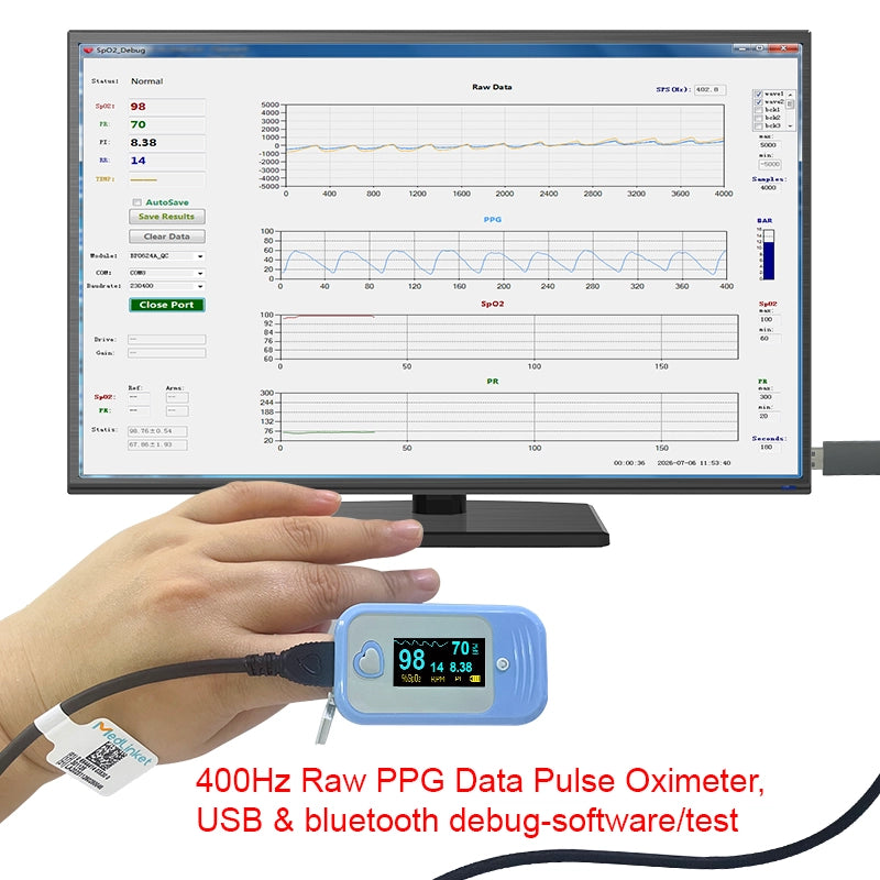 400Hz Raw PPG Data Pulse Oximeter