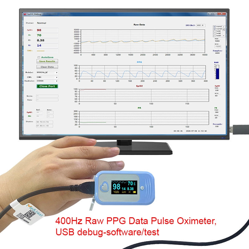 400Hz Raw PPG Data Pulse Oximeter