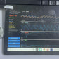 400Hz Raw PPG Data Pulse Oximeter with Bluetooth & USB