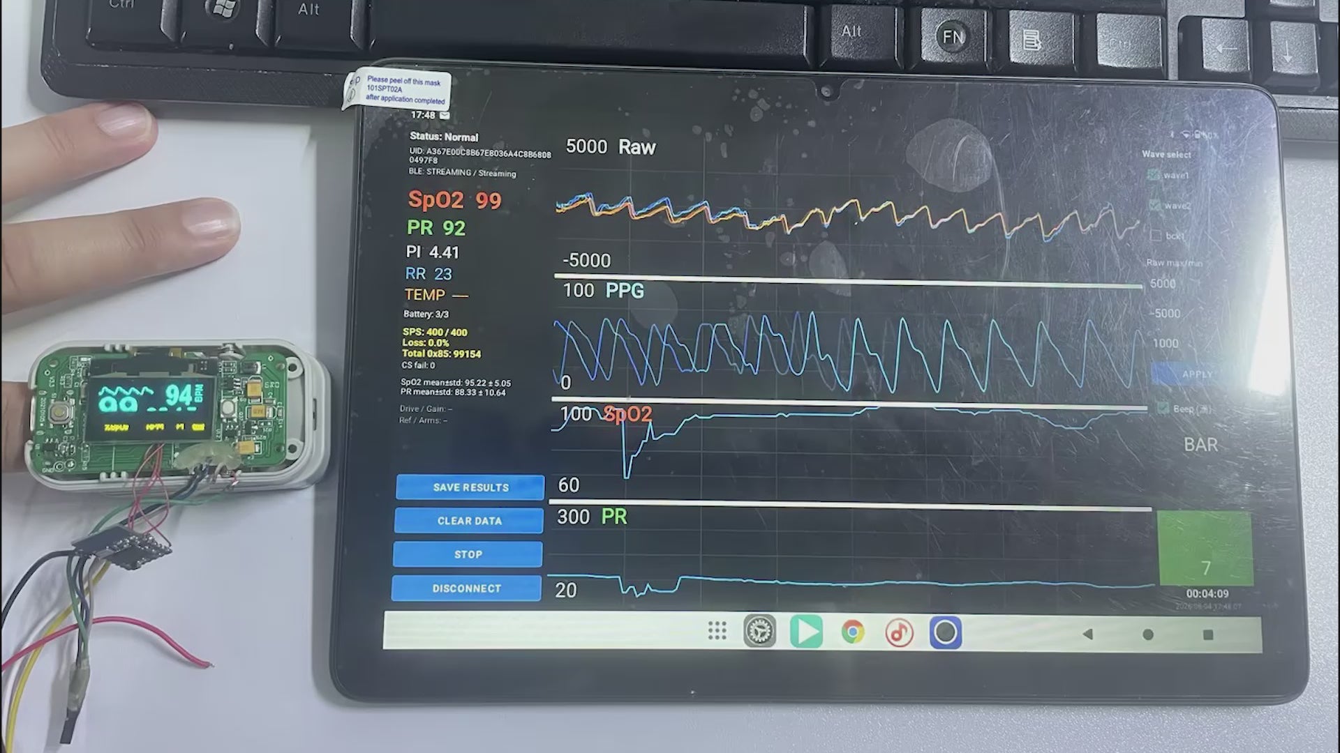 400Hz Raw PPG Data Pulse Oximeter with Bluetooth & USB